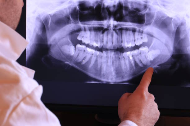 Best Urgent Dental Care for Toothache in Moxee, WA