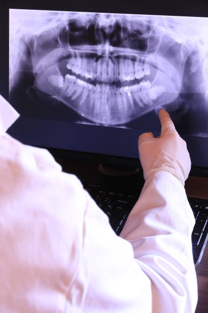 Best Emergency Dentist for Lost Fillings or Crowns in Moxee, WA