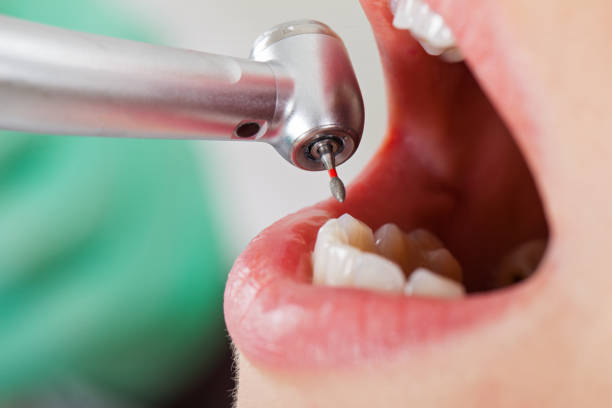 Best Pediatric Emergency Dentist in Moxee, WA
